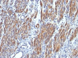Myosin heavy chain 11 Antibody (SMMS-1), Novus Biologicals 0.2mg; Unlabeled:Antibodies,